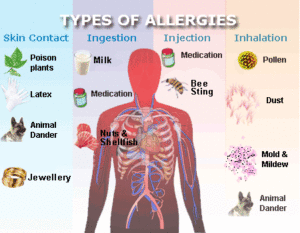 Allergies