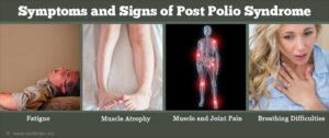 Post-polio syndrome
