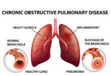 Diseases of the Lungs