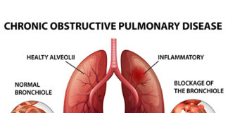 Diseases of the Lungs