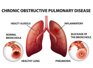 Diseases of the Lungs