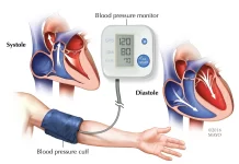 Hypertension