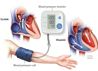 Hypertension