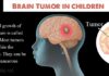 Brain tumors in children