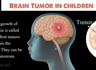 Brain tumors in children