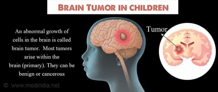 Brain tumors in children