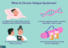 Chronic Fatigue Syndrome