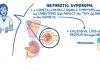 Nephrotic Syndrome